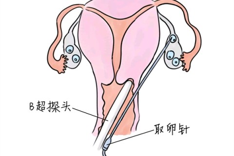 http://quanzhou.vdtfzz.com/post/205.html|泉州供卵助孕