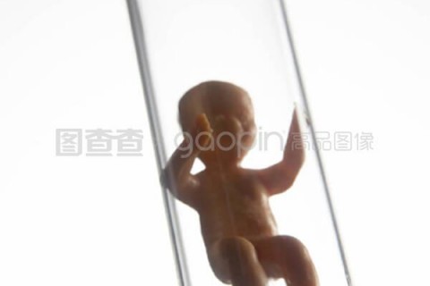 http://quanzhou.vdtfzz.com/post/197.html|泉州试管助孕
